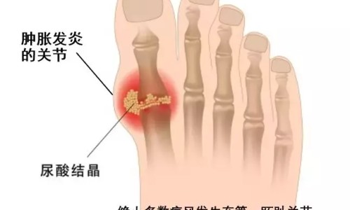 注射用头孢呋辛钠说明书深圳网 - 注射用头孢呋辛钠多少钱一瓶,注射用头孢呋辛钠1g说明书